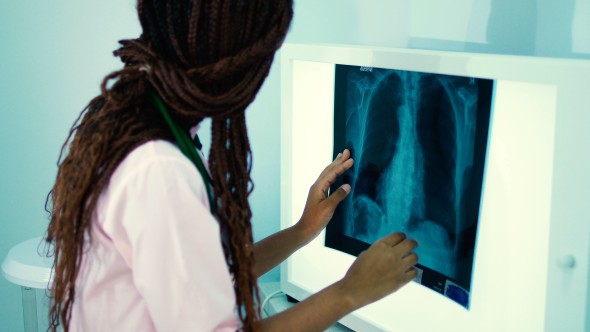 La fluorographie est une option de recherche importante.